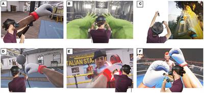 Virtual Reality Body Image Training for Chronic Low Back Pain: A Single Case Report